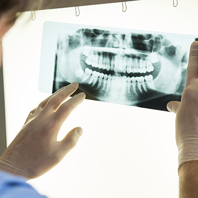 Cinema Smile Dental | Dental Bridges, Implant Dentistry and Cosmetic Dentistry